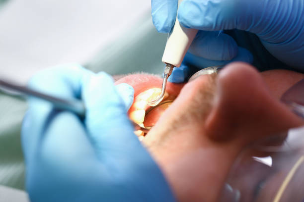 Best Mobile Emergency Dentist in Haskell, OK