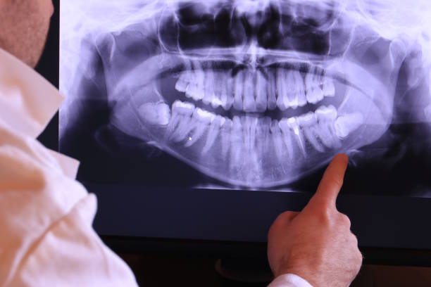 Best Emergency Dental Extractions in Haskell, OK