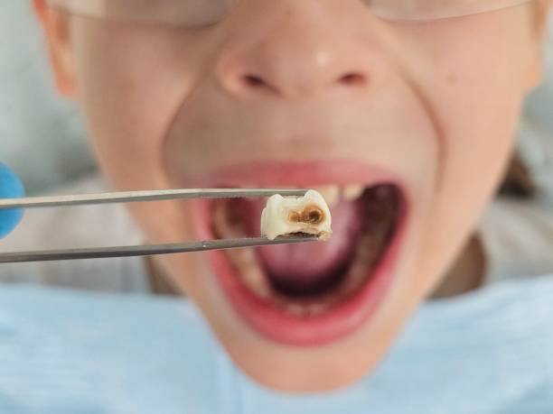 Best Emergency Dentist for Special Needs Patients in Haskell, OK